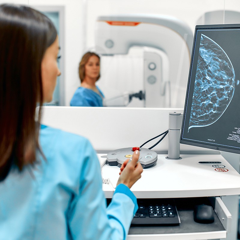 2021-magsul-site-exames-mamografia-800x800pxjpg_NCqAJp83F9Xgh5D2FV3NsTfmrrDoBNdippwoQXcz.jpeg